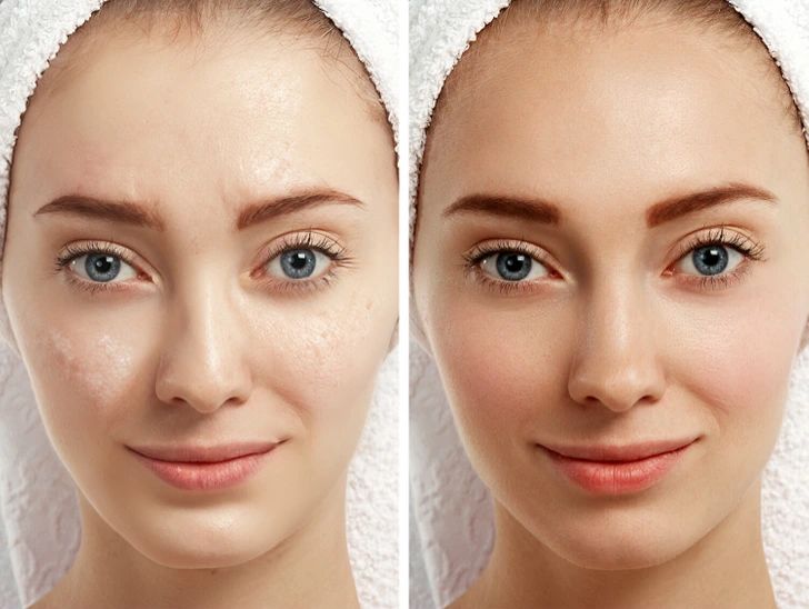 8 këshilla nga dermatologu për lëkurë rrezatuese në mot të ftohtë