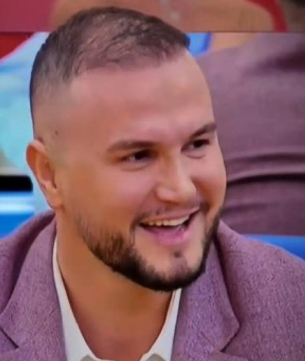 Dalin pamjet, ja si dukej banori i “Big Brother” para ndërhyrjeve estetike
