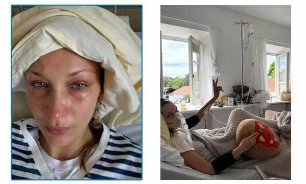 Përkeqësohet gjendja shëndetësore e Bella Hadid, publikon foto nga shtrati i spitalit: Më vjen keq që gjithmonë zhdukem